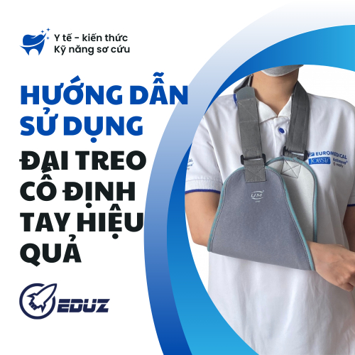 Hướng Dẫn Sử Dụng Đai Treo Cố Định Tay Hiệu Quả